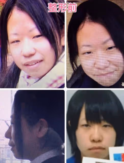 日本妹子因長得丑被欺凌，花400萬整成美女，神似「有村架純」