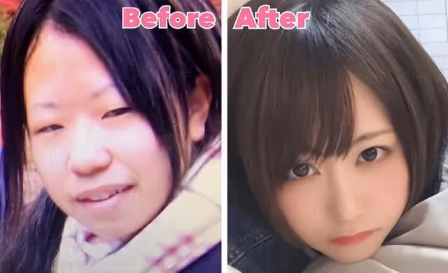 日本妹子因長得丑被欺凌，花400萬整成美女，神似「有村架純」