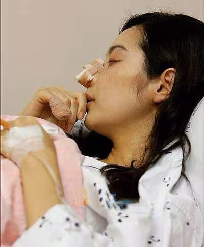 奉子閃婚的悲劇：新婚13天，女星被丈夫斬斷手指，流產終生不孕