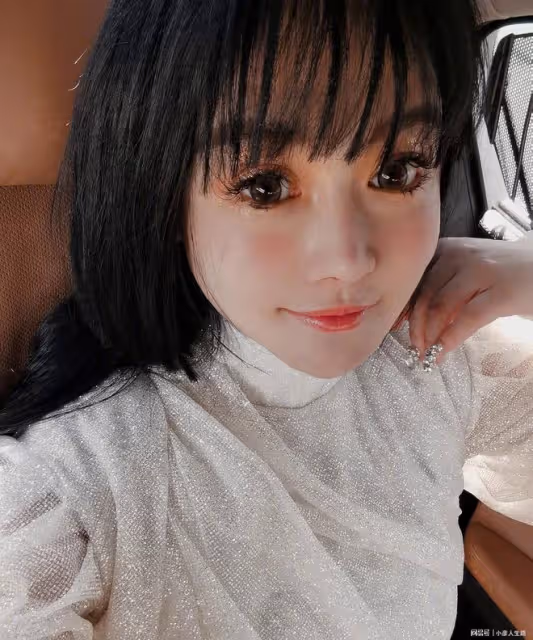 她又陷入整容爭議了!近照誇張變形到認不出,網友:暴發戶審美