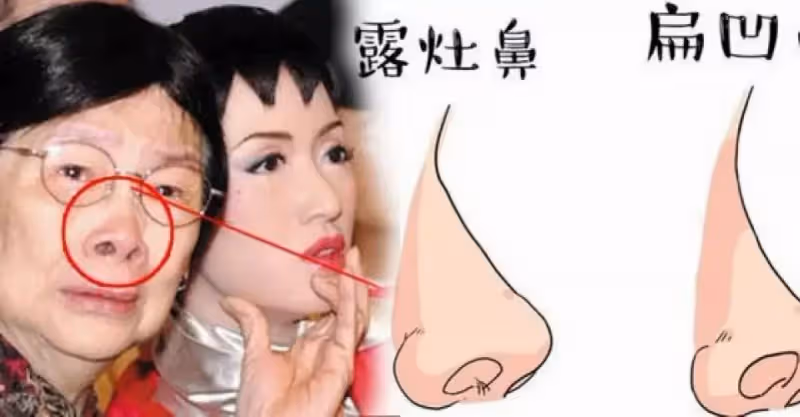 這三種鼻子一生【難富貴】，希望你沒有！