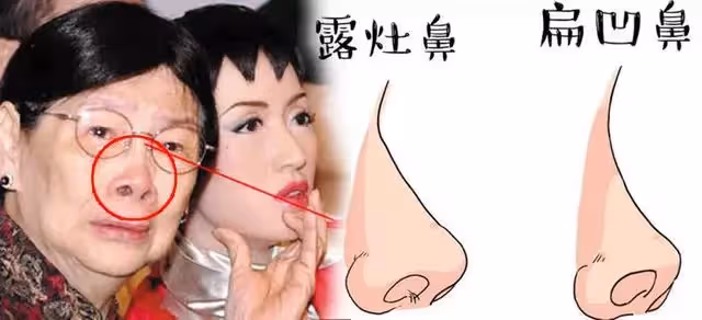 這三種鼻子一生【難富貴】，希望你沒有！