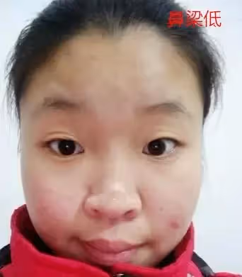 這三種鼻子一生【難富貴】，希望你沒有！