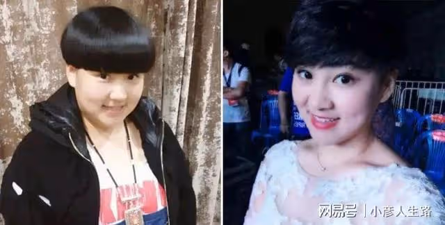 楊樹林老婆胖丫抽脂減肥,雙腿腫脹包裹滲血紗布