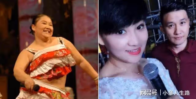 楊樹林老婆胖丫抽脂減肥,雙腿腫脹包裹滲血紗布