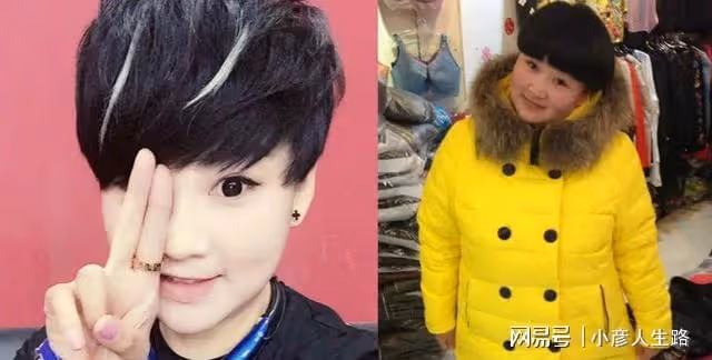 楊樹林老婆胖丫抽脂減肥,雙腿腫脹包裹滲血紗布