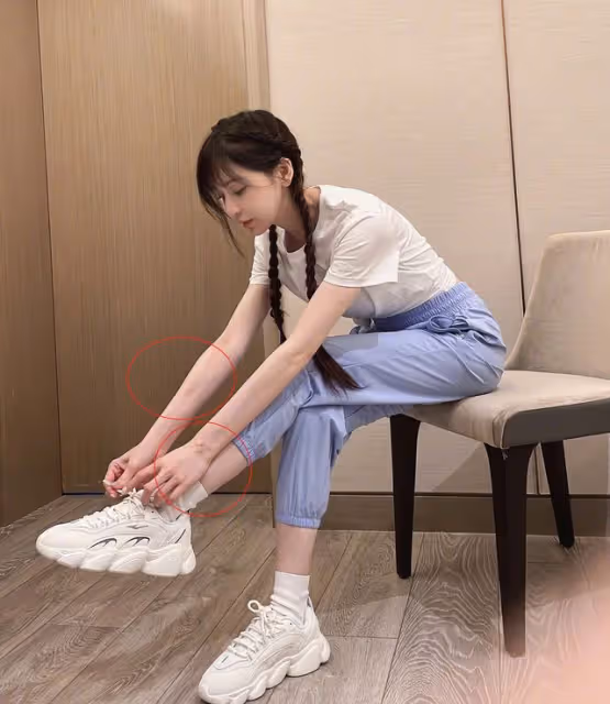 王心凌深夜緊急就醫畫面曝光!膝蓋疑嚴重變形,四肢乾瘦惹人心疼