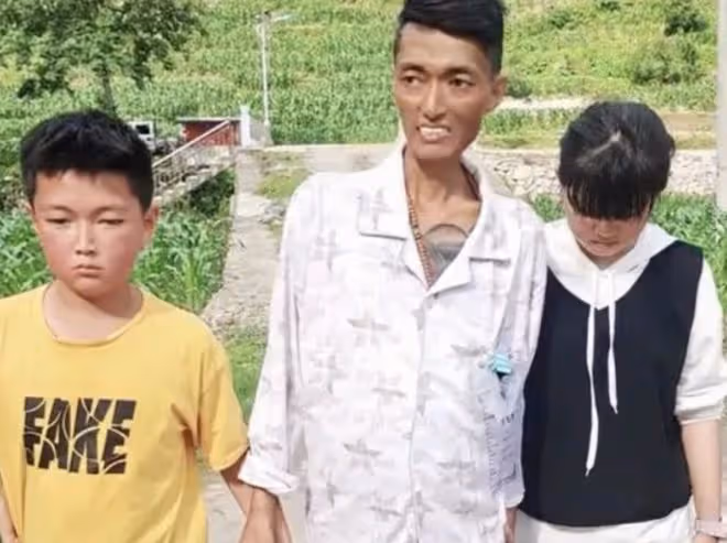 半個月3位網紅癌症去世!有人臨終前瘦到皮包骨,有人死後捐遺體