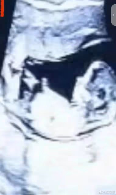34歲男星官宣結婚喜訊！女方B超照曝光，小寶貝兒鼻樑高挺隨爸爸