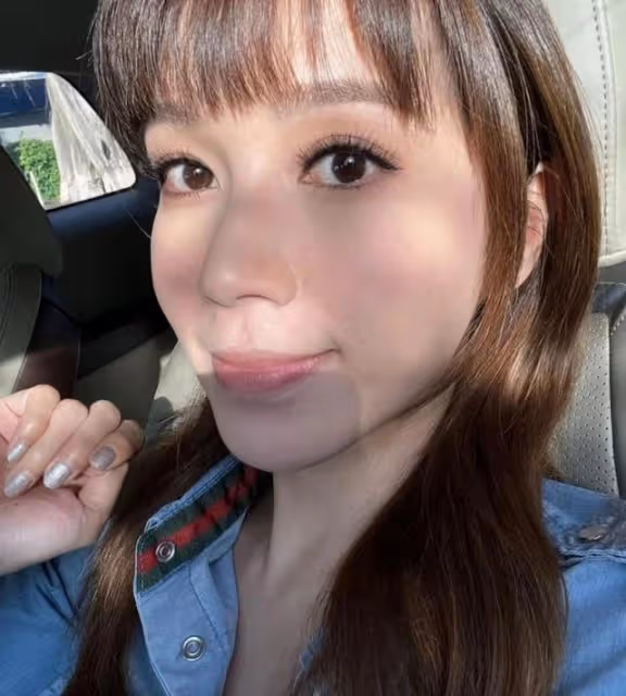 禍不單行！TVB人氣小花胸口長滿紅色小疙瘩，睡覺更受蚊蟲叮咬