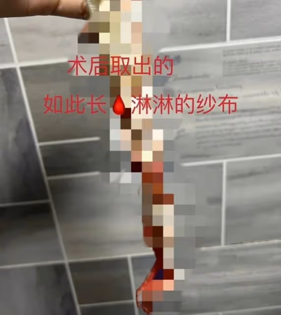 內娛嘻哈歌手爆雷！女友髮長文泣訴染病經歷，還有三名女生也遭難