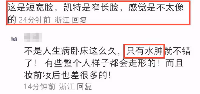 凱特王妃術後首露面,臉型變了滄桑太多,王室地位發生變化!