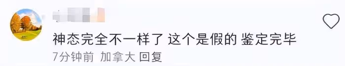 凱特王妃術後首露面!面頰圓潤鼻子變塌惹質疑,威廉王子反應心虛