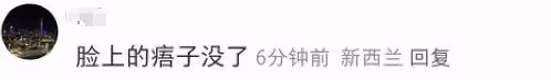 凱特王妃術後首露面！面頰圓潤鼻子變塌惹質疑，威廉王子反應心虛