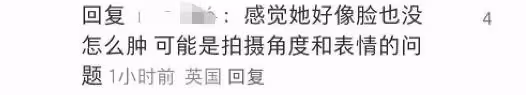 凱特王妃術後首露面！面頰圓潤鼻子變塌惹質疑，威廉王子反應心虛