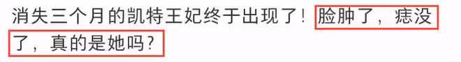 王室公布凱特王妃新行程!前後不一惹質疑,這次露面如「換頭」!