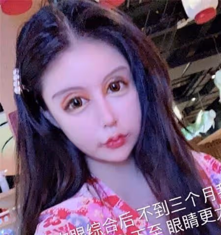 女孩為了變美,花100萬瘋狂整容,揚言母親支持,前後對比如換臉