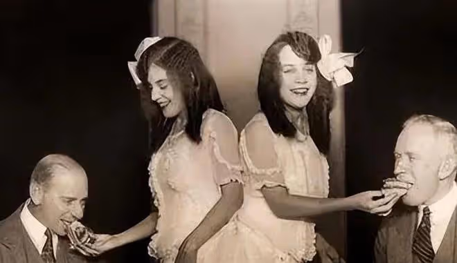 英國臀部連體姐妹:出生就被賤賣,姐姐死後,妹妹拖著遺體去世