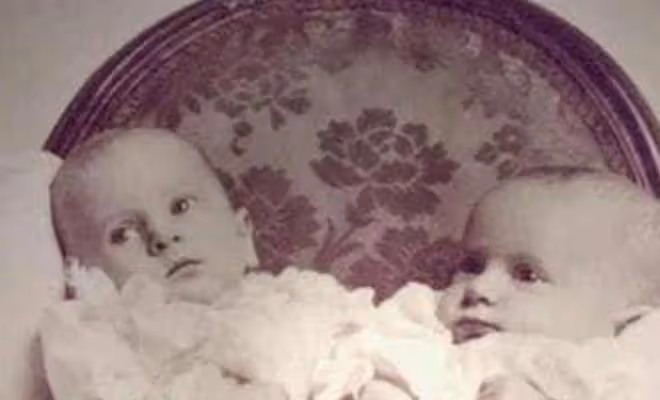英國臀部連體姐妹:出生就被賤賣,姐姐死後,妹妹拖著遺體去世
