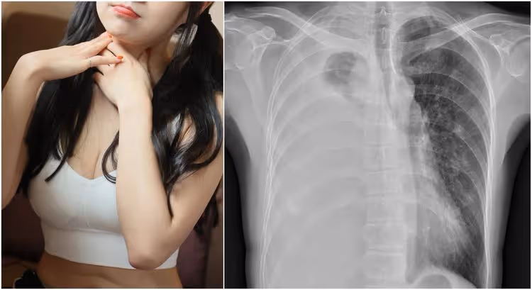 她咳1個月驗出肺癌末　醫師曝關鍵時間點！必做這動作