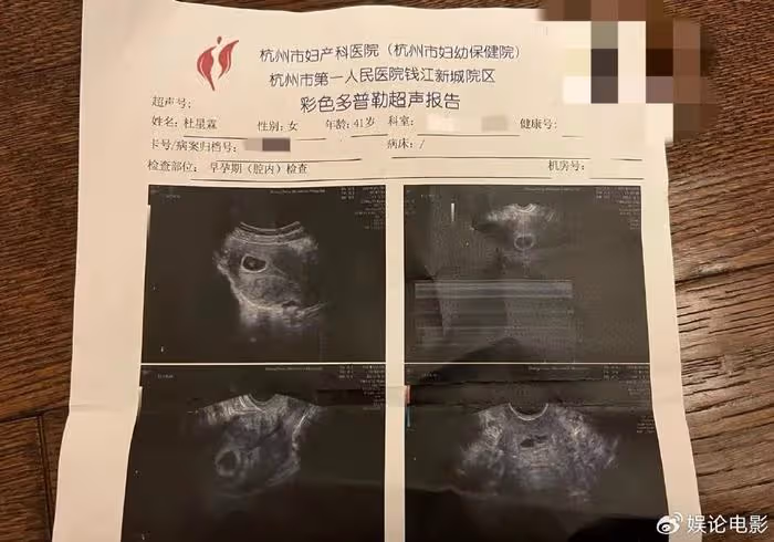 恭喜!張紀中小31歲老婆杜星霖又雙叒叕懷孕,他們已育有兩個孩子