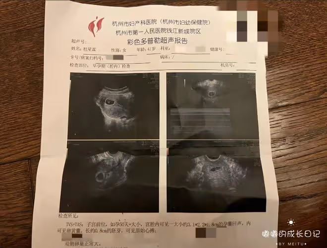 72歲張紀中再當爹,42歲嬌妻杜星霖官宣四胎,曬彩超已懷孕50天