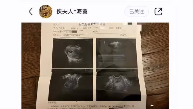 73歲張紀中導演再當爸，42歲妻子官宣懷第三胎，恭喜！