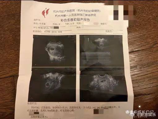 72歲張紀中又當爸！小31歲嫩妻曬驗孕棒懷龍胎…夫妻7年生3娃