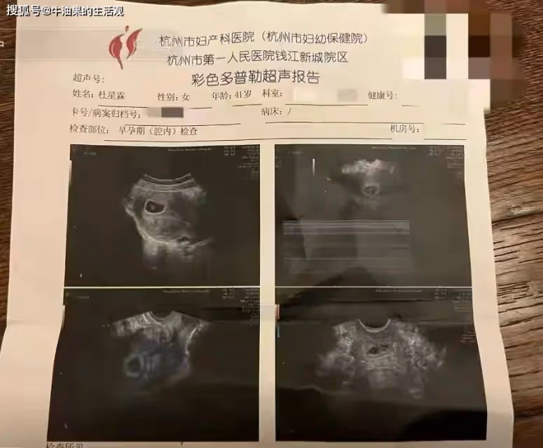 73歲張紀中寶刀未老再當爸,杜星霖懷三胎,爺孫戀也有真愛