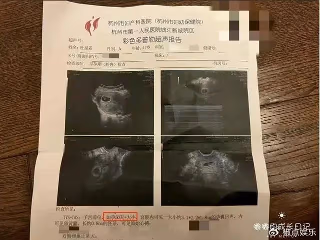 73歲張紀中喜迎第5個孩子!三婚妻子杜星霖懷4胎,混血兒身世曝光