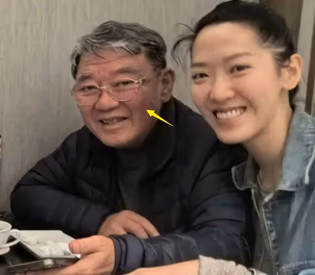 74歲劉松仁瘦脫相,口齒不清疑中風,堅持丁克晚年淒涼!