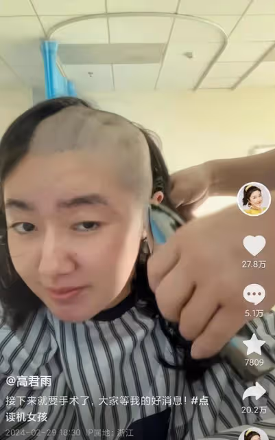 曝22歲「點讀機女孩」造假!多細節曝去年做的手術,已關閉評論!