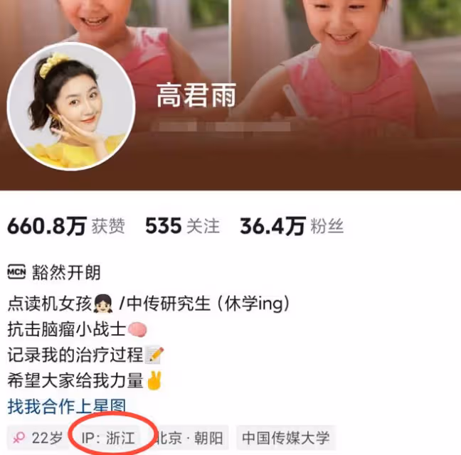 曝22歲「點讀機女孩」造假!多細節曝去年做的手術,已關閉評論!