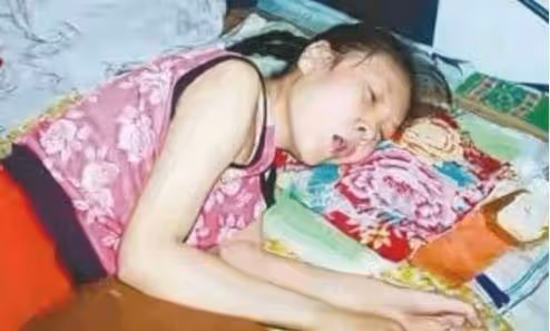 被哥哥甩2巴掌!15歲妹妹「癱瘓20年」暴瘦至30公斤 監控拍下「詭異一幕」妹妹的秘密被拆穿