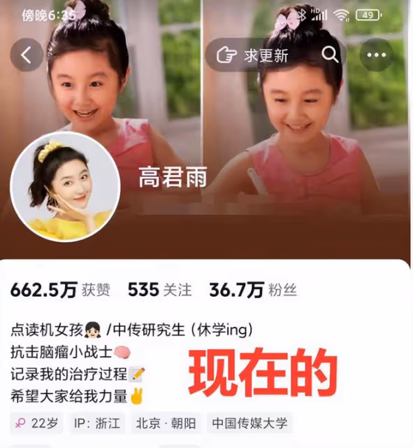 「點讀機女孩」媽媽承認造假，甩鍋運營公司，網友評價一針見血！