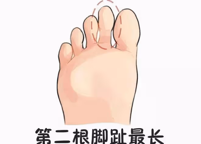 「二拇腳趾長，長大了不養娘」，為何這樣說？有道理