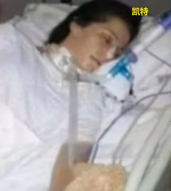 凱特搶救畫面疑首曝光,脖子疑做了氣管切開手術,和傳聞吻合了