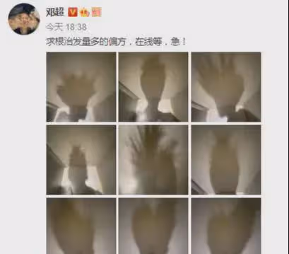45歲鄧超和李乃文上海拍戲，風吹暴露禿頂，明星也逃不開禿頂煩惱