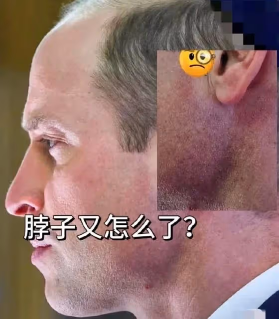 外媒發圖暗示凱特被控制!威廉有暴力傾向,凱特遭遇家暴生死不明