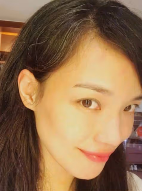 47歲的舒淇「毀容式」照片曝光，滿頭白髮面容蒼老，已經放飛自我