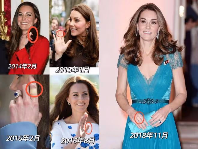 英媒曝威廉有暴力傾向,凱特疑遭其家暴去世,此前手上多次有傷!