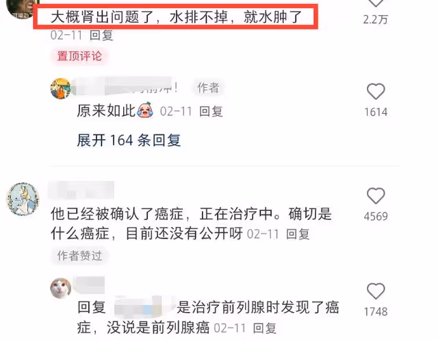 英媒曝查爾斯國王去世！2月份確診癌症，手指多次腫脹太嚇人！