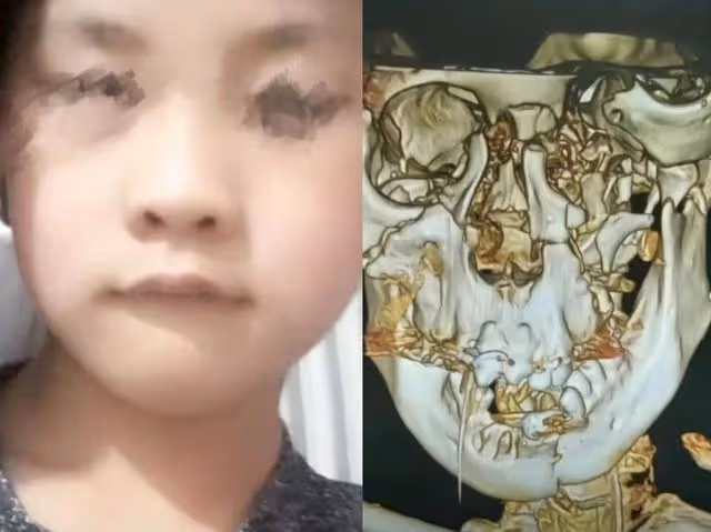 後續！邯鄲被害男孩屍檢！父親懷疑另有幫凶，村民透露內情！