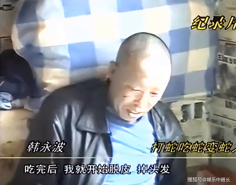 遼寧男子吃蛇竟然變「蛇人」,身上長出鱗片,蛇肉究竟能不能吃?