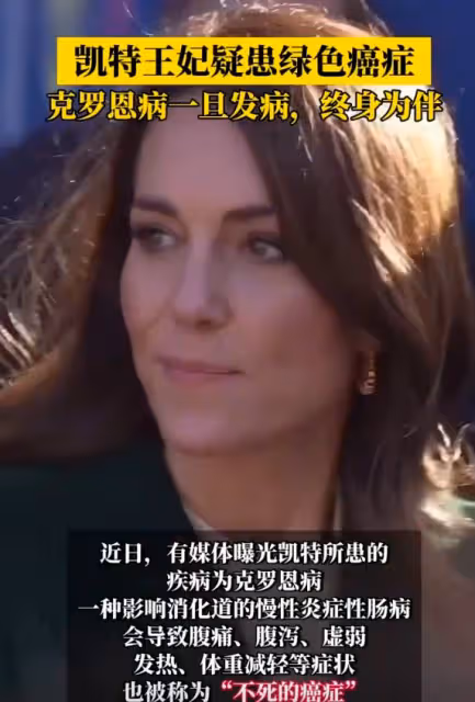 外媒堅稱凱特已去世!前三周行程被扒,為救查爾斯被光明會血祭!