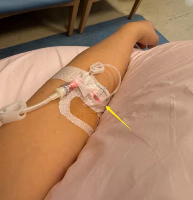 劉維手術後道歉!自曝患病經過,凌晨3點去醫院,圈內僅一人陪伴