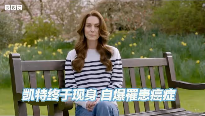 凱特最新視頻:假髮、假背景,病得很嚴重,所患癌症揭曉!