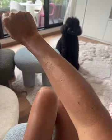 吳速玲嚴重曬傷!臉和腿「至少差8色階」 對比藍心湄傻眼:真的是木炭
