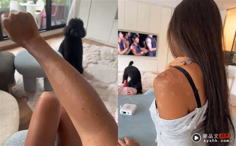 吳速玲嚴重曬傷！臉與腿竟差8色階成黑炭　腿一伸出對比藍心湄超傻眼
