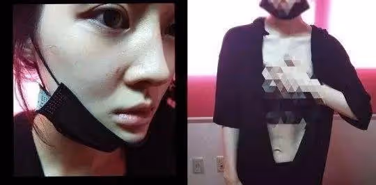 即將離婚展開新生活的女星半夜輕生，緊急送醫後，仍在昏迷中...